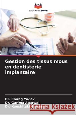 Gestion des tissus mous en dentisterie implantaire Yadav, Dr. Chirag, Agarwal, Dr. Garima, Bhaumik, Dr. Kaushitaki 9786208743376 Editions Notre Savoir - książka