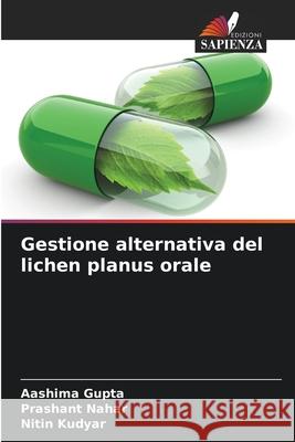 Gestione alternativa del lichen planus orale Aashima Gupta Prashant Nahar Nitin Kudyar 9786207675630 Edizioni Sapienza - książka