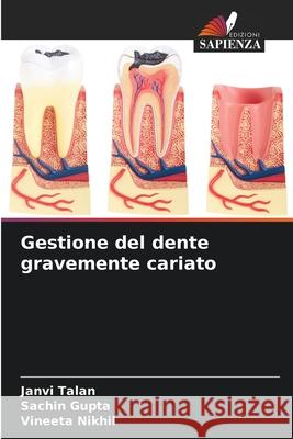 Gestione del dente gravemente cariato Janvi Talan Sachin Gupta Vineeta Nikhil 9786207766819 Edizioni Sapienza - książka