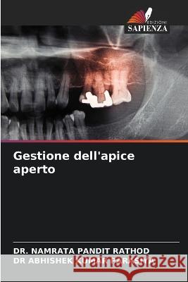 Gestione dell'apice aperto Dr Namrata Pandit Rathod Dr Abhishek Kumar Parasiya  9786206095224 Edizioni Sapienza - książka