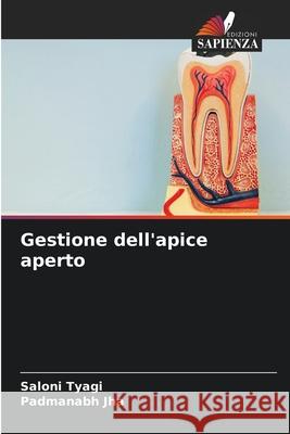 Gestione dell'apice aperto Saloni Tyagi Padmanabh Jha 9786207673346 Edizioni Sapienza - książka