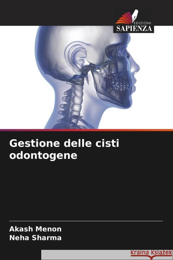 Gestione delle cisti odontogene Menon, Akash, Sharma, Neha 9786204515786 Edizioni Sapienza - książka