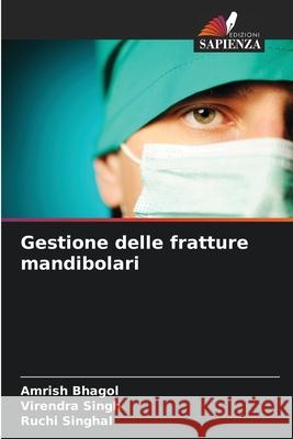 Gestione delle fratture mandibolari Amrish Bhagol Virendra Singh Ruchi Singhal 9786207695430 Edizioni Sapienza - książka