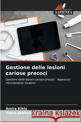 Gestione delle lesioni cariose precoci Amira Kikly Sabra Ja?foura 9786207714216 Edizioni Sapienza - książka