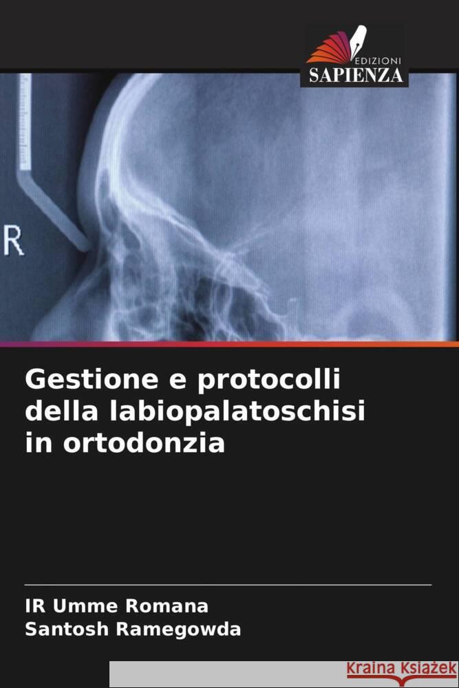 Gestione e protocolli della labiopalatoschisi in ortodonzia Romana, IR Umme, Ramegowda, Santosh 9786204419336 Edizioni Sapienza - książka