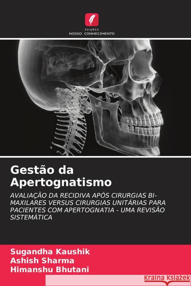 Gestão da Apertognatismo Kaushik, Sugandha, Sharma, Ashish, Bhutani, Himanshu 9786206368724 Edições Nosso Conhecimento - książka