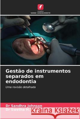 Gestão de instrumentos separados em endodontia Johnson, Dr Sandhra, H. B., Dr Swetha 9786202422666 Edições Nosso Conhecimento - książka