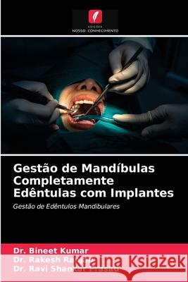 Gestão de Mandíbulas Completamente Edêntulas com Implantes Dr Bineet Kumar, Dr Rakesh Ranjan, Dr Ravi Shankar Prasad 9786203662436 Edicoes Nosso Conhecimento - książka