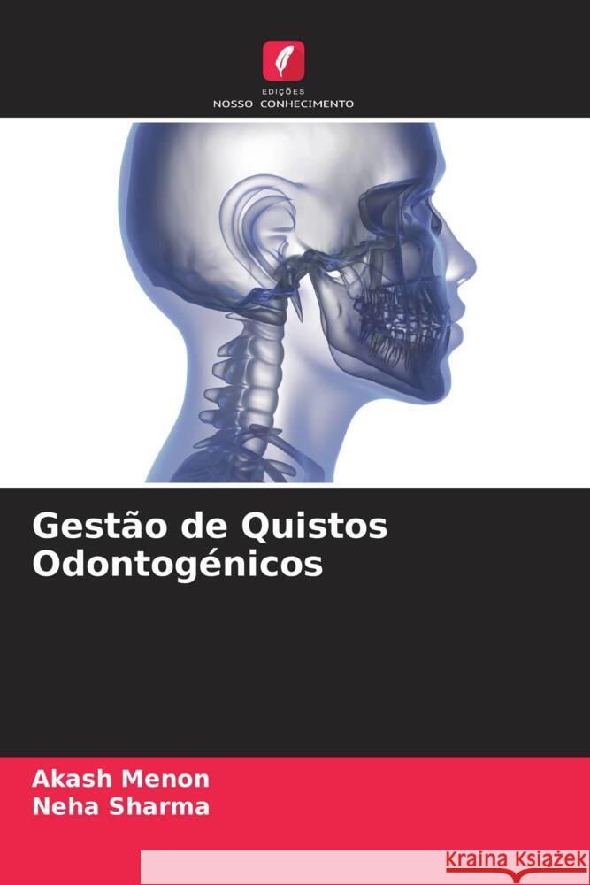 Gestão de Quistos Odontogénicos Menon, Akash, Sharma, Neha 9786204515793 Edições Nosso Conhecimento - książka