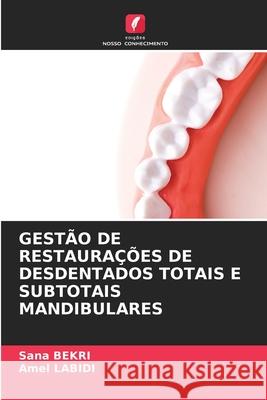 GESTÃO DE RESTAURAÇÕES DE DESDENTADOS TOTAIS E SUBTOTAIS MANDIBULARES Bekri, Sana, Labidi, Amel 9786208850258 Edições Nosso Conhecimento - książka