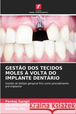 GESTÃO DOS TECIDOS MOLES À VOLTA DO IMPLANTE DENTÁRIO Gangil, Pankaj, Arora, Sachitanand, Das, Jeevika 9786208473747 Edições Nosso Conhecimento - książka