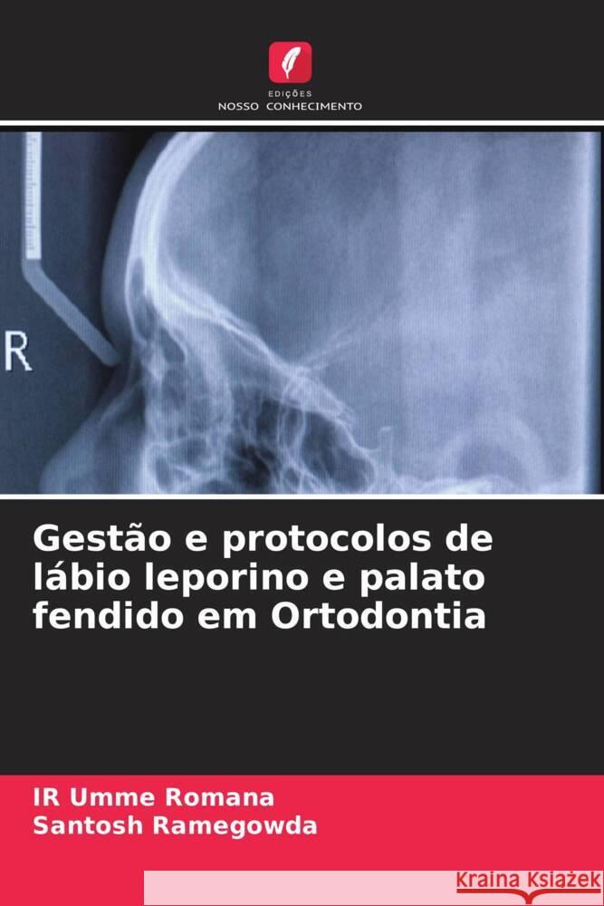 Gestão e protocolos de lábio leporino e palato fendido em Ortodontia Romana, IR Umme, Ramegowda, Santosh 9786204419343 Edições Nosso Conhecimento - książka