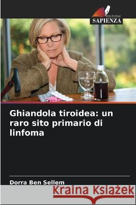 Ghiandola tiroidea: un raro sito primario di linfoma Dorra Ben Sellem   9786205817476 Edizioni Sapienza - książka