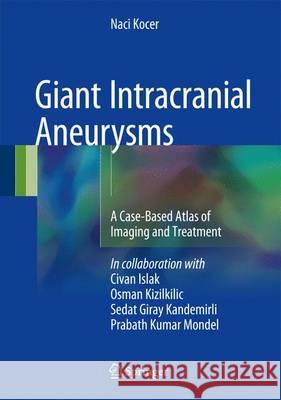 Giant Intracranial Aneurysms: A Case-Based Atlas of Imaging and Treatment Kocer, Naci 9783319417868 Springer - książka