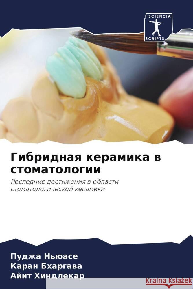 Gibridnaq keramika w stomatologii N'üase, Pudzha, Bhargawa, Karan, Hindlekar, Ajit 9786206141082 Sciencia Scripts - książka