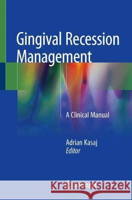 Gingival Recession Management: A Clinical Manual Kasaj, Adrian 9783319707174 Springer - książka