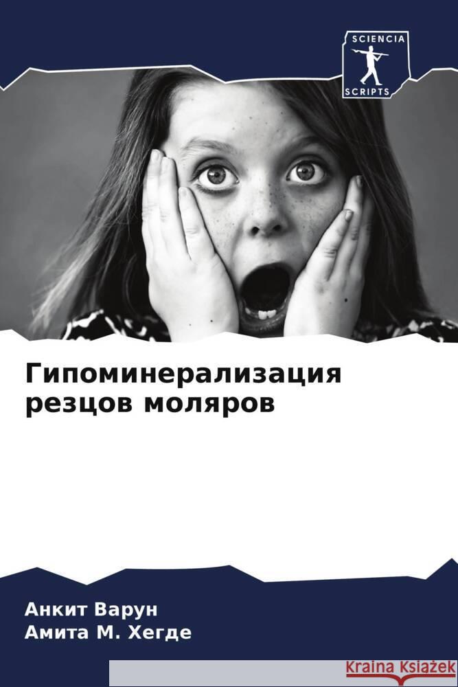 Gipomineralizaciq rezcow molqrow Varun, Ankit, Hegde, Amita M. 9786207130559 Sciencia Scripts - książka