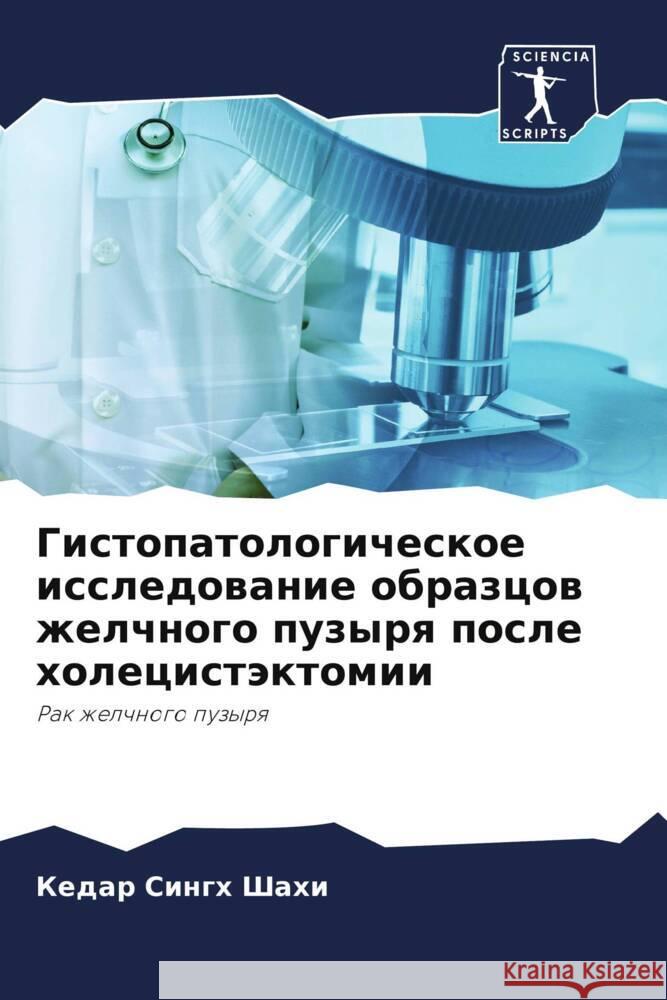 Gistopatologicheskoe issledowanie obrazcow zhelchnogo puzyrq posle holecistäktomii Shahi, Kedar Singh, Shukla, Sanzheew Kumar 9786205088586 Sciencia Scripts - książka