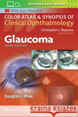 Glaucoma Wills Eye Hospital                       Douglas J. Rhee 9781496363480 LWW - książka