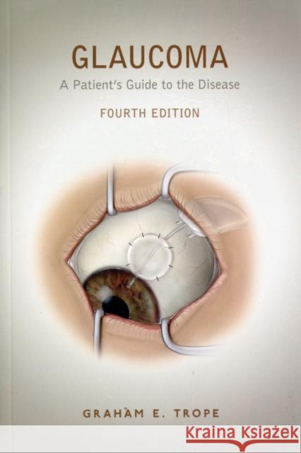 Glaucoma: A Patient's Guide to the Disease Trope, Graham E. 9780802094735  - książka
