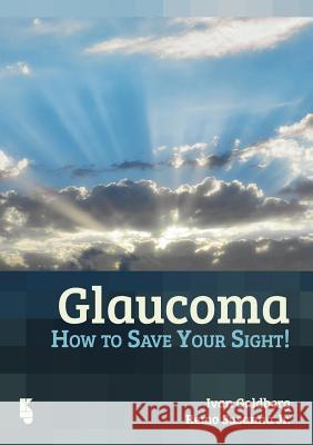 Glaucoma: How to Save Your Sight Remo Susann Ivan Goldberg Gustavo Muradas-Reiss 9789062992423 Kugler Publications - książka