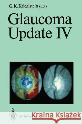 Glaucoma Update IV G. K. Krieglstein 9783642760860 Springer - książka