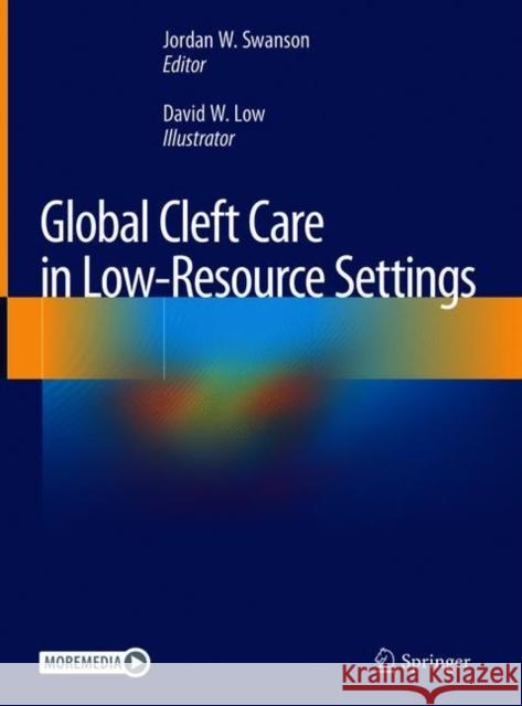 Global Cleft Care in Low-Resource Settings Swanson, Jordan W. 9783030591045 Springer - książka