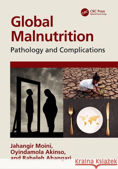 Global Malnutrition: Pathology and Complications Jahangir Moini Oyindamola Akinso Raheleh Ahangari 9781032295350 CRC Press - książka