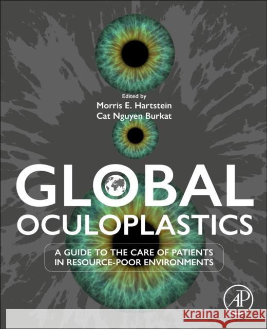 Global Oculoplastics: A Guide to the Care of Patients in Resource-Poor Environments Morris E Cat Nguyen Burkat 9780443219689 Elsevier Science Publishing Co Inc - książka