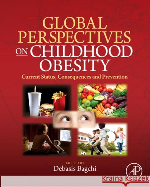 Global Perspectives on Childhood Obesity: Current Status, Consequences and Prevention Bagchi, Debasis 9780123749956  - książka