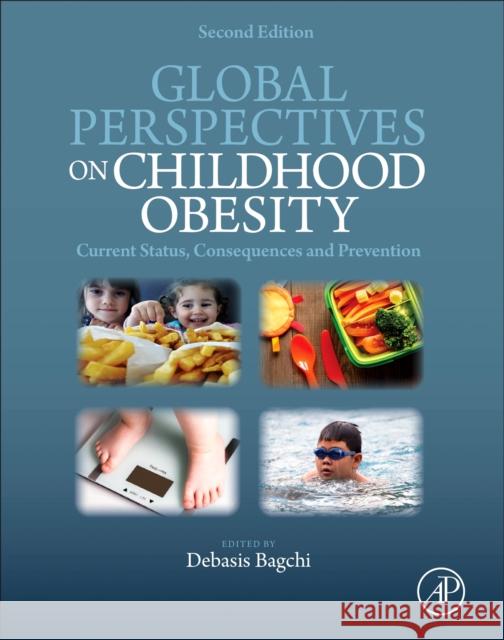 Global Perspectives on Childhood Obesity: Current Status, Consequences and Prevention Bagchi, Debasis 9780128128404 Academic Press - książka