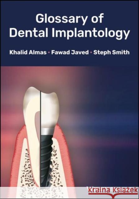 Glossary of Dental Implantology Khalid Almas Javed                                    Steph Smith 9781118626887 Wiley-Blackwell - książka