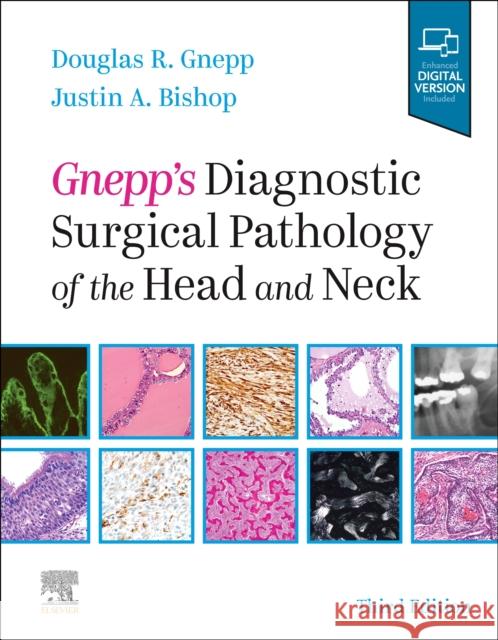 Gnepp's Diagnostic Surgical Pathology of the Head and Neck Douglas R. Gnepp Justin A. Bishop 9780323531146 Elsevier - książka