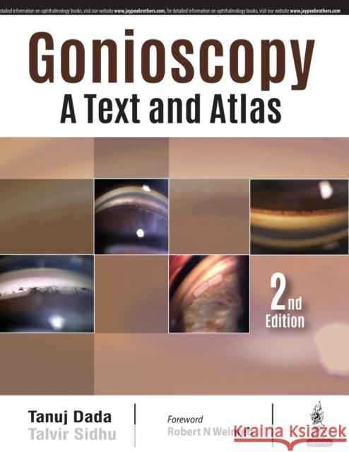 Gonioscopy: A Text and Atlas Tanuj Dada 9789352701520 Jp Medical Ltd - książka