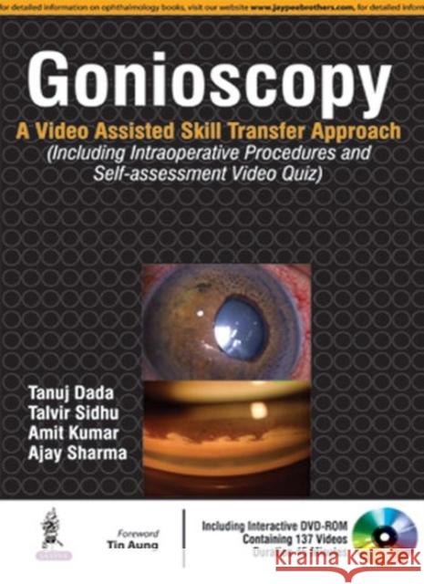 Gonioscopy: A Video Assisted Skill Transfer Approach Tanuj Dada 9789352501915 Jaypee Brothers, Medical Publishers Pvt. Ltd. - książka