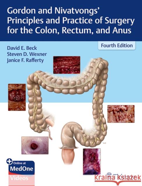 Gordon and Nivatvongs' Principles and Practice of Surgery for the Colon, Rectum, and Anus Beck, David E. 9781626234291 Thieme Medical Publishers - książka