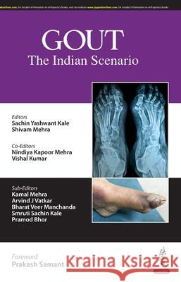 Gout Vishal Kumar 9789366168654 Jaypee Brothers Medical Publishers - książka