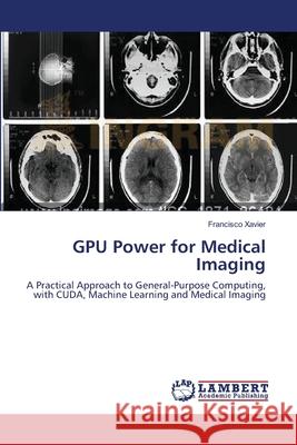GPU Power for Medical Imaging Xavier, Francisco 9783659251894 LAP Lambert Academic Publishing - książka