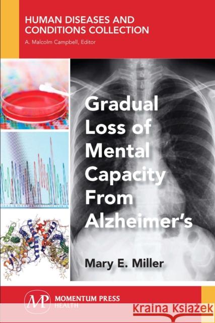 Gradual Loss of Mental Capacity from Alzheimer's Mary E. Miller 9781944749774 Momentum Press - książka