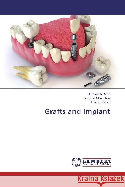 Grafts and Implant Rana, Saraswati; Chandhok, Tushyata; Dangi, Pawan 9783330035706 LAP Lambert Academic Publishing - książka