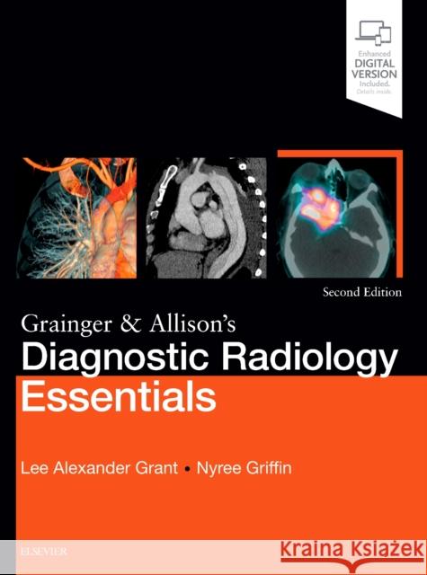 Grainger & Allison's Diagnostic Radiology Essentials Lee A. Grant Nyree Griffin 9780702073113 Elsevier - książka