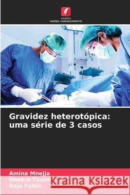 Gravidez heterot?pica: uma s?rie de 3 casos Amina Mnejja Dhekra Toumi Raja Faleh 9786207588947 Edicoes Nosso Conhecimento - książka