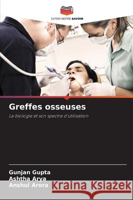 Greffes osseuses Gupta, Gunjan, Arya, Ashtha, Arora, Anshul 9786208799755 Editions Notre Savoir - książka