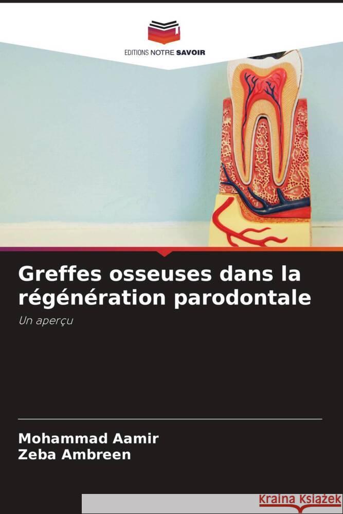 Greffes osseuses dans la r?g?n?ration parodontale Mohammad Aamir Zeba Ambreen 9786208634667 Editions Notre Savoir - książka