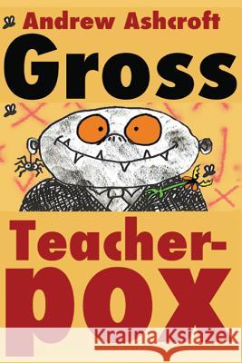 Gross Teacherpox b/w: Budget Version Ashcroft, Andrew 9781502394637 Createspace - książka