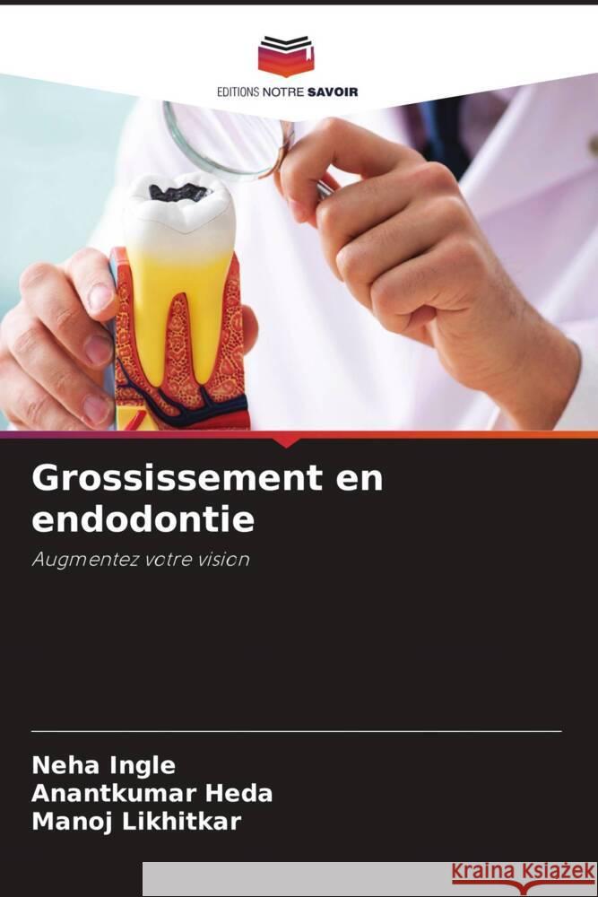 Grossissement en endodontie Neha Ingle Anantkumar Heda Manoj Likhitkar 9786208077006 Editions Notre Savoir - książka