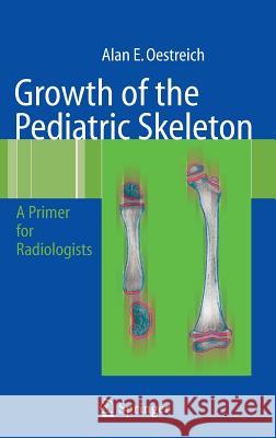 Growth of the Pediatric Skeleton: A Primer for Radiologists Oestreich, Alan Emil 9783540376880 Not Avail - książka