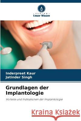 Grundlagen der Implantologie Inderpreet Kaur Jatinder Singh 9786202209274 Verlag Unser Wissen - książka