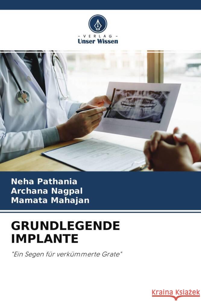 GRUNDLEGENDE IMPLANTE Pathania, Neha, Nagpal, Archana, Mahajan, Mamata 9786204417325 Verlag Unser Wissen - książka