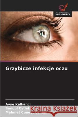 Grzybicze infekcje oczu Kalkanci, Ayse, Ozdek, Sengul, Ozmen, Mehmet Cuneyt 9786209380945 Wydawnictwo Nasza Wiedza - książka